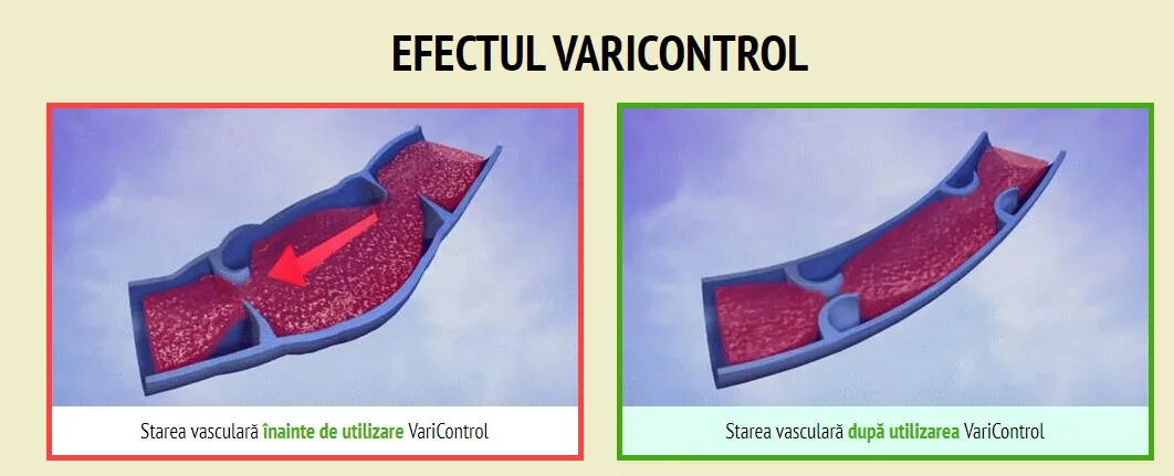 Varcosin : gdje kupiti u Hrvatskoj, u ljekarni?